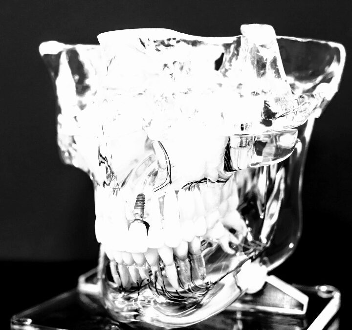 Energieblockaden durch beherdete Zähne erkennen